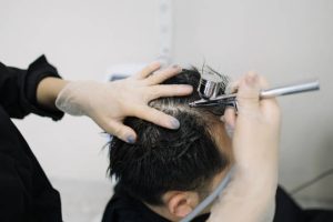 Hair Transplant Benefits, Procedure, and Recovery Explained